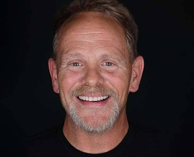Dental Implants in Langdon