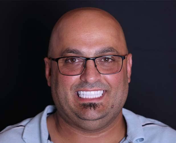 Dental Implants Near You